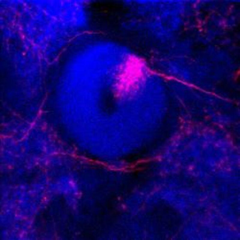 A microscope image of a thick blue ring with a wedge of pink neuron branches making up part of it, and a pink line extending out of the ring from the wedge.