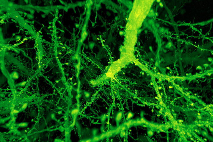 Fluorescent microscopy of green dendritic branches studded with small rounded spines.