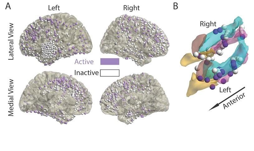 Panel A shows many small purple and white circles distributed across four brain reconstructions shown in two columns and two rows. The columns are labeled Left and Right and the rows are labeled Lateral View and Medial View.