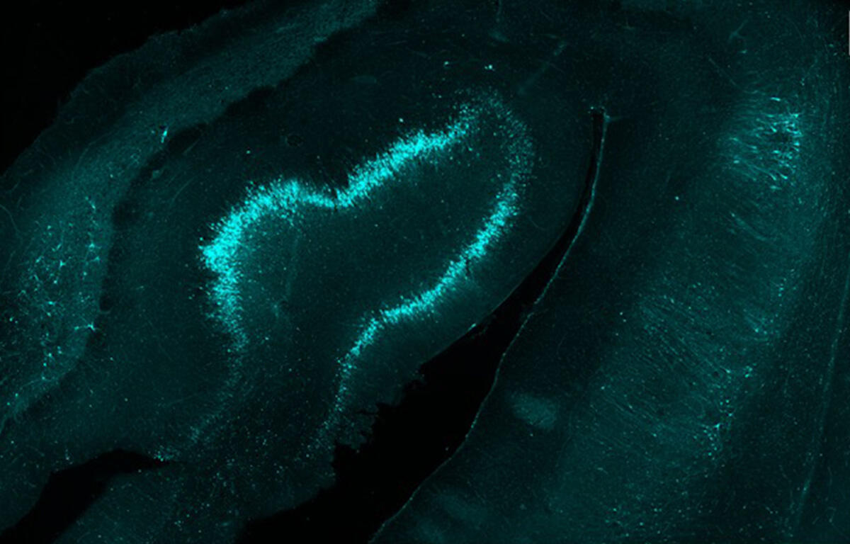 A microscopy image of a brain slice, mostly black with some cells glowing cyan. The brightest cyan cells are aligned in an irregular U-shape.